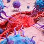 Enfermedades autoinmunes: cuando el cuerpo se ataca a sí mismo