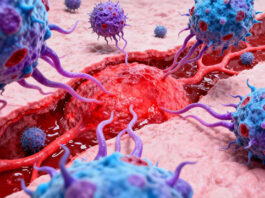 Enfermedades autoinmunes: cuando el cuerpo se ataca a sí mismo